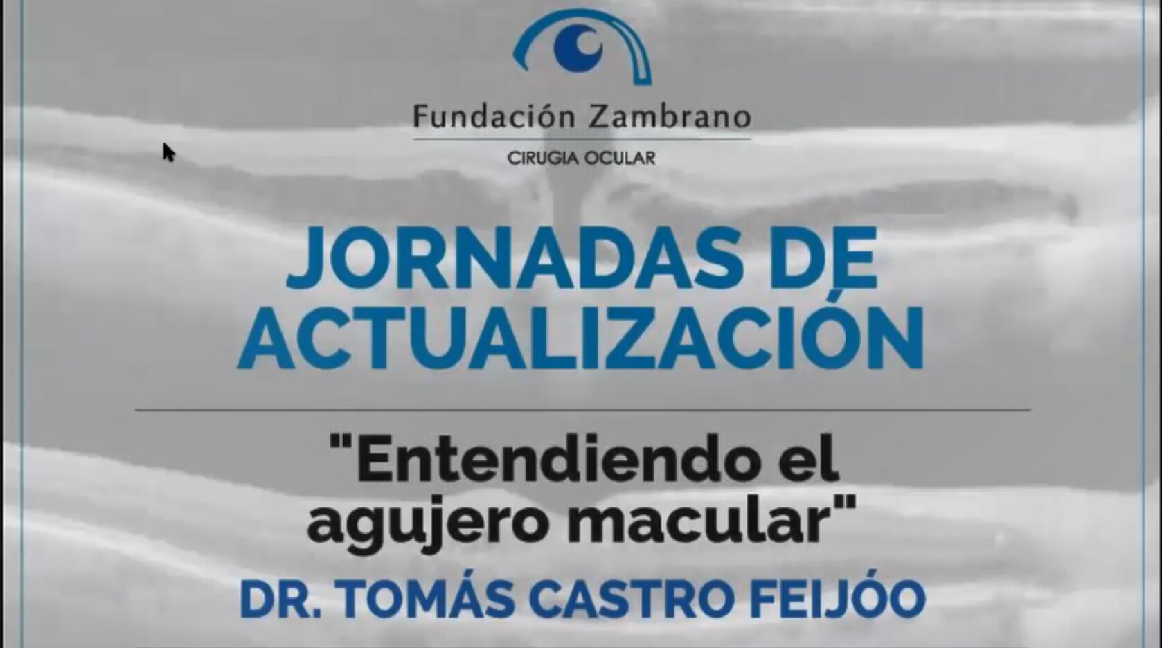 Jornadas de Actualización. Entendiendo el agujero macular