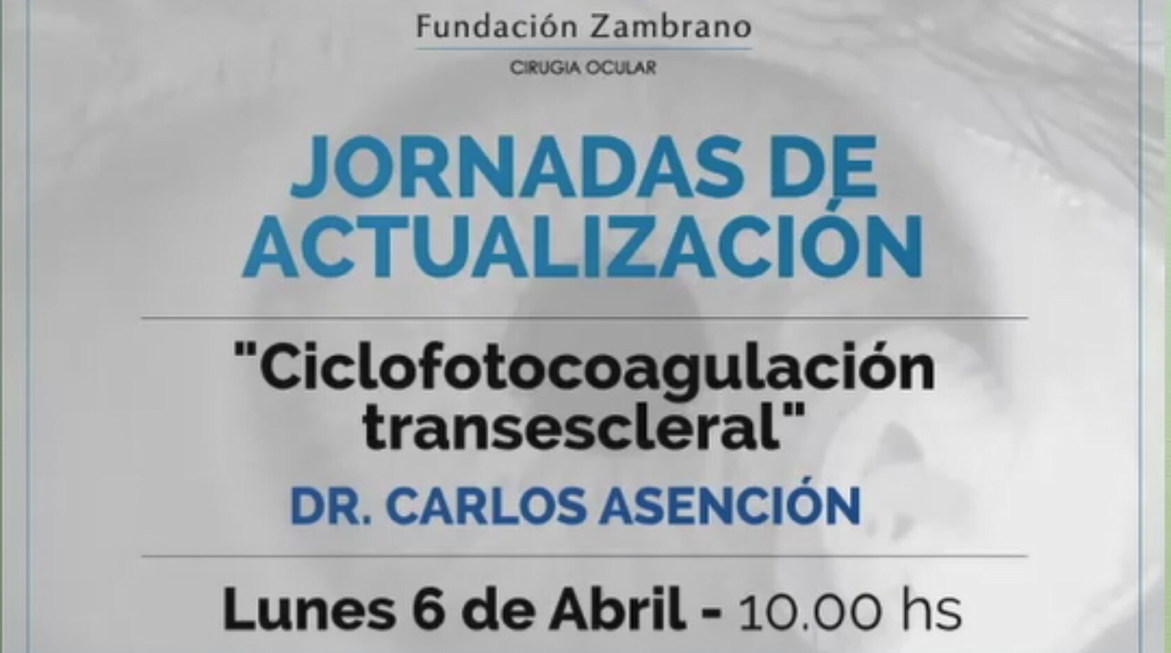 Jornadas de Actualización. Ciclofotocoagulación transescleral