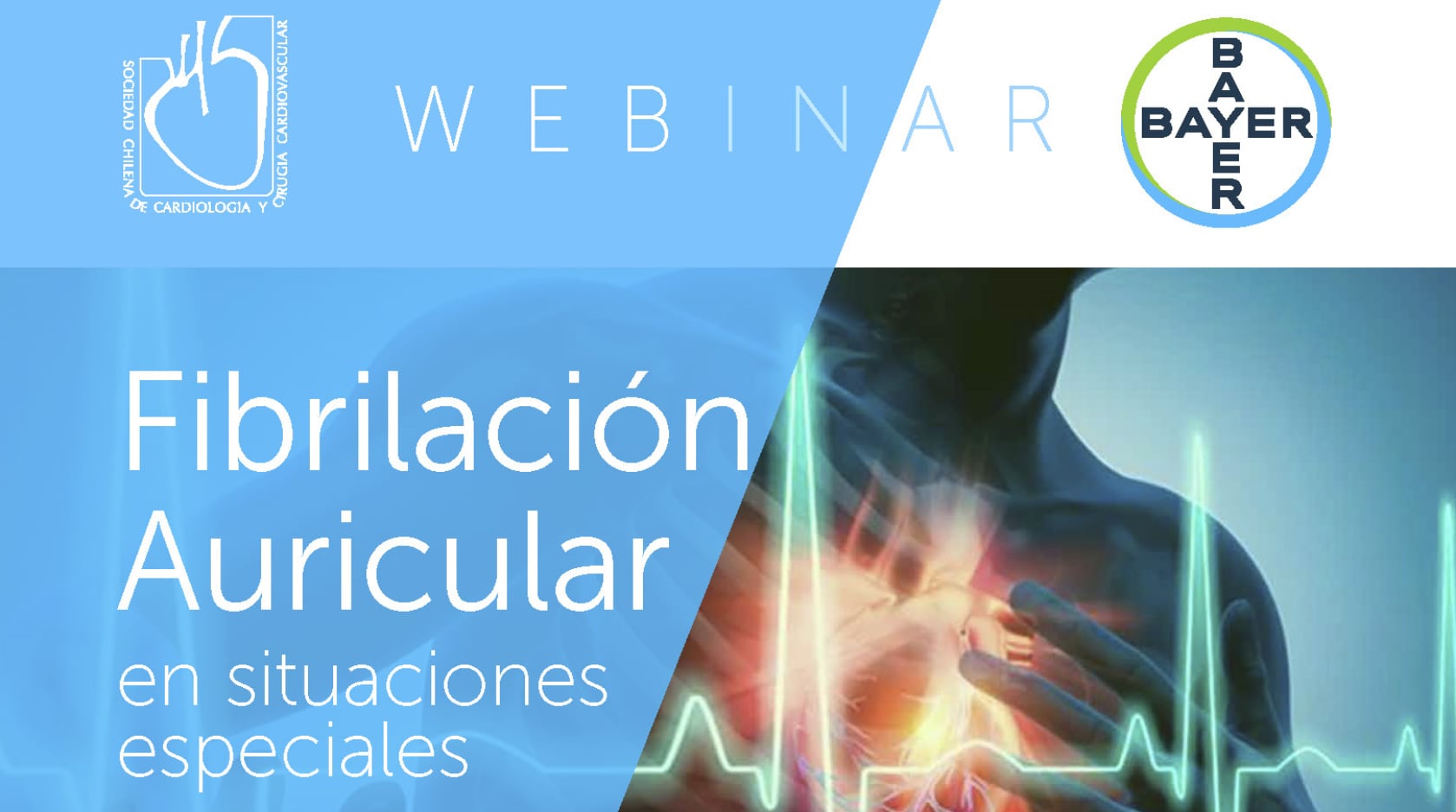 Fibrilación Auricular en situaciones especiales